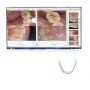 Smart Intra Oral Camera System 21 Inches